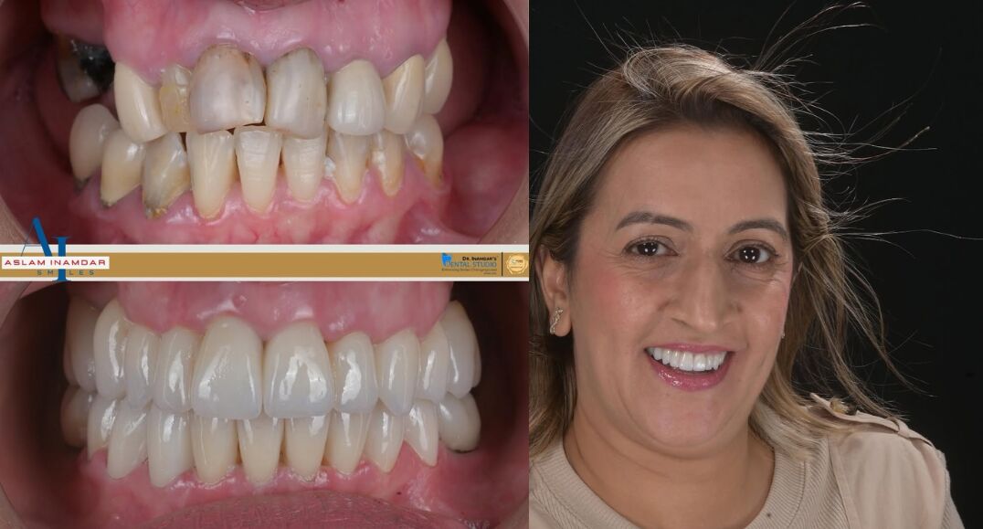 Muscat, Dental, Dentist In Mumbai Redefining Smiles With Digital Precision
