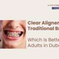 Clear Aligners Vs. Traditional Braces: Which Is Better For Adults In Dubai? &mdash; AFFORD