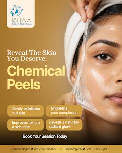 Hyderabad, Health, Chemical Peel Treatment In Chandanagar