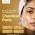 Chemical Peel Treatment In Chandanagar