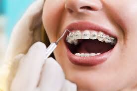 Bangalore, Dental, Affordable Dental Implants