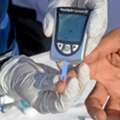 ¿Buscas Acupuntura Para Dolor De Espalda? Conoce Tus Opciones | Pasaporte A La Salud
