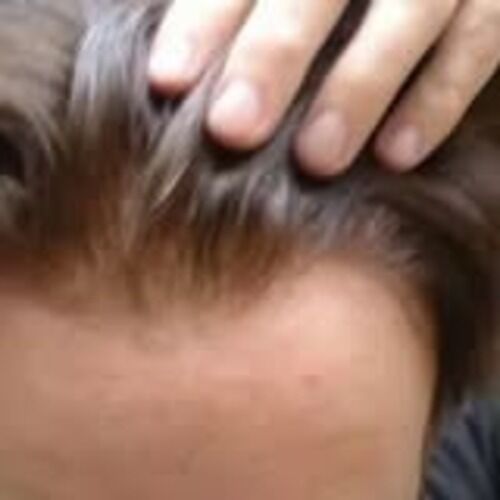 New York, Health, Find Quality Custom Made Hair Pieces For Any Style