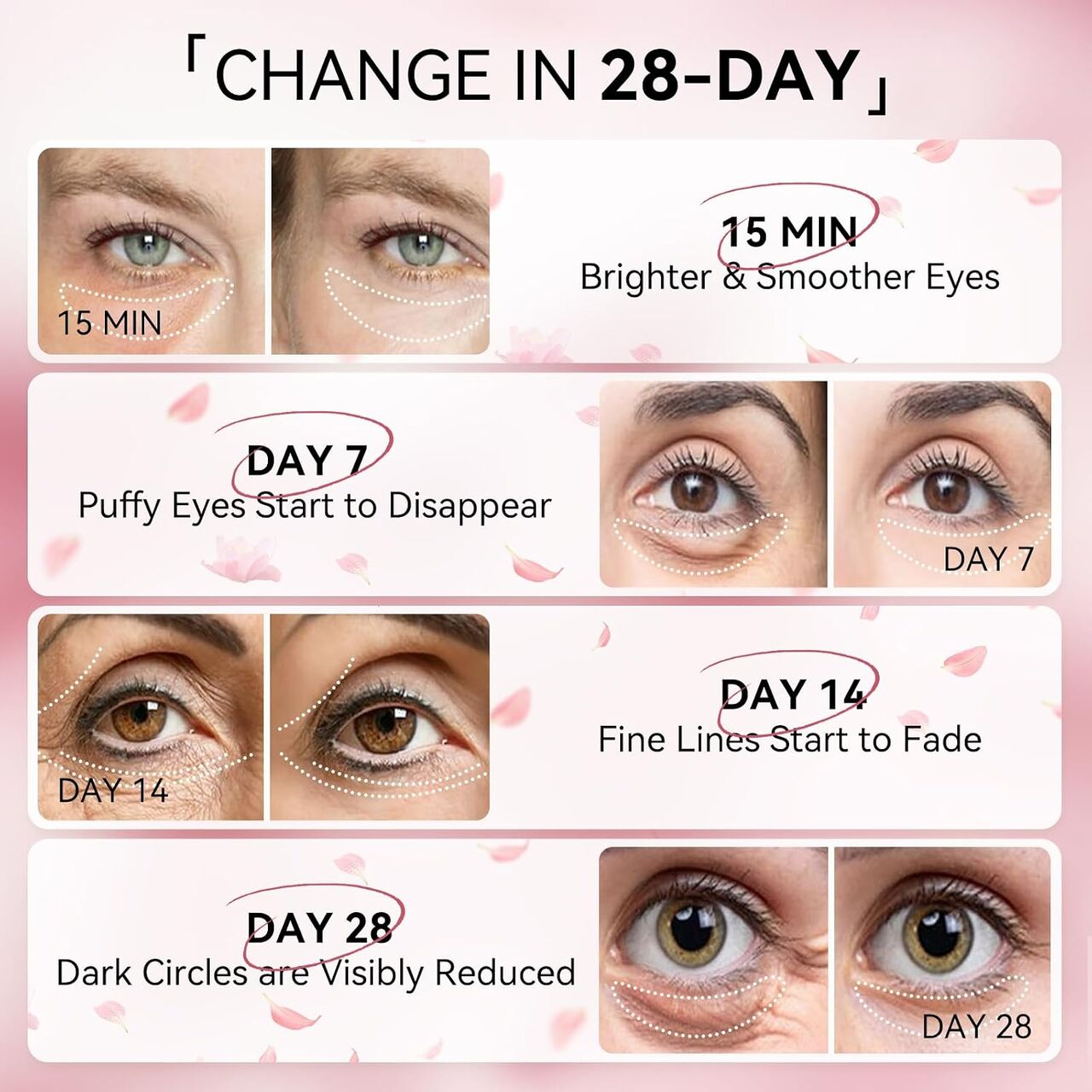 New York, General, BREYLEE Flamingo Pink Eye Mask&ndash;60 Pcs-Puffy Eyes And Dark Circles Treatments&ndash;Look Younger