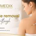 Safe & Effective Mole Removal In Bentleigh | Medixskincare
