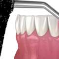 Advanced Gum Care At Agrawal Dental Clinic