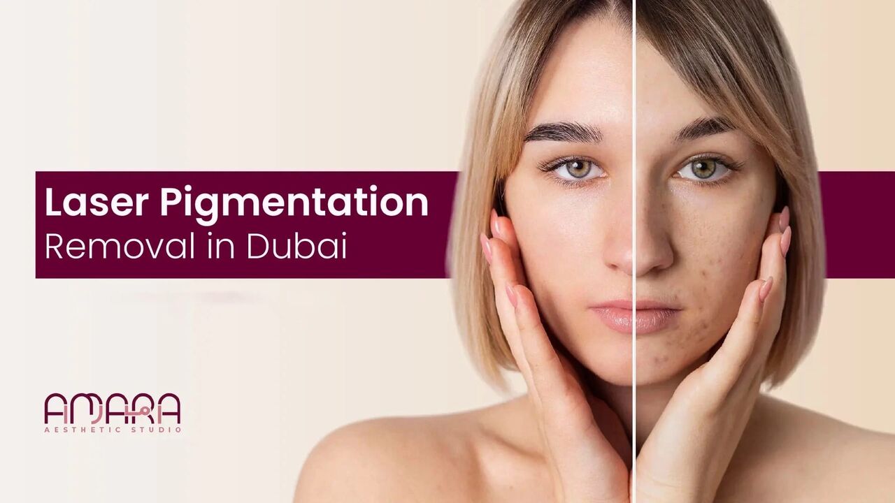 Dubai, Health, Laser Pigmentation Removal In Dubai, UAE