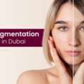 Laser Pigmentation Removal In Dubai, UAE