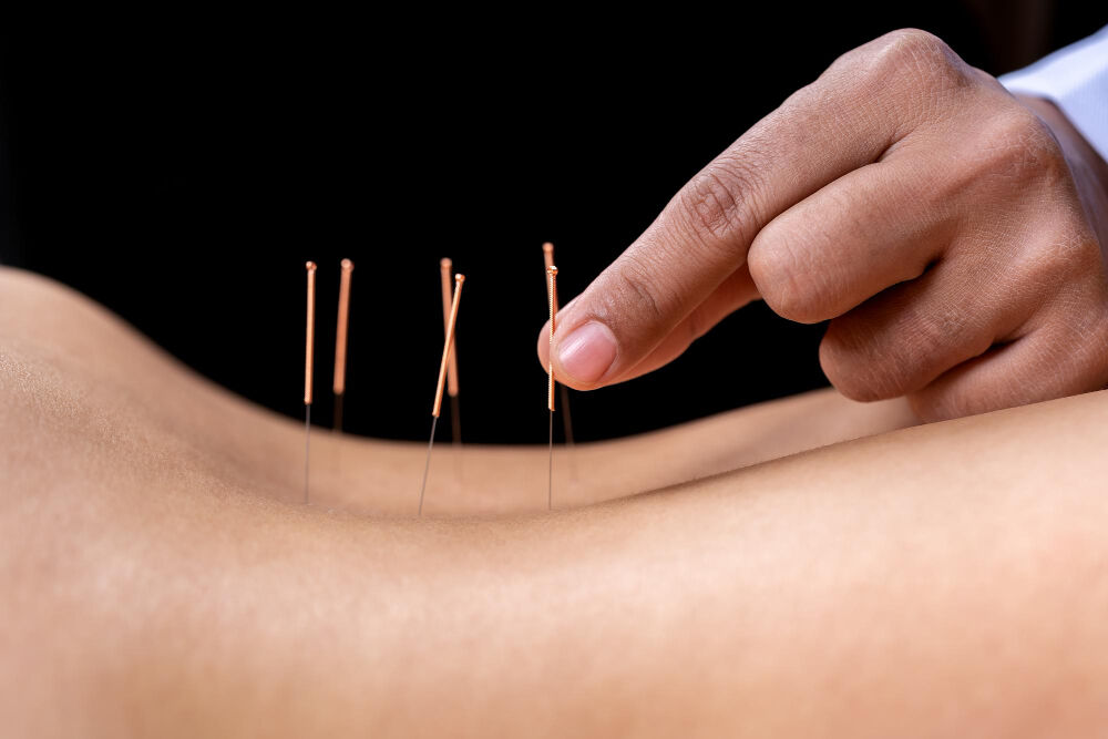 Mexico City, Health, ¿Por Qué Considerar Un Tratamiento Quiropráctico Para Tu Bienestar?