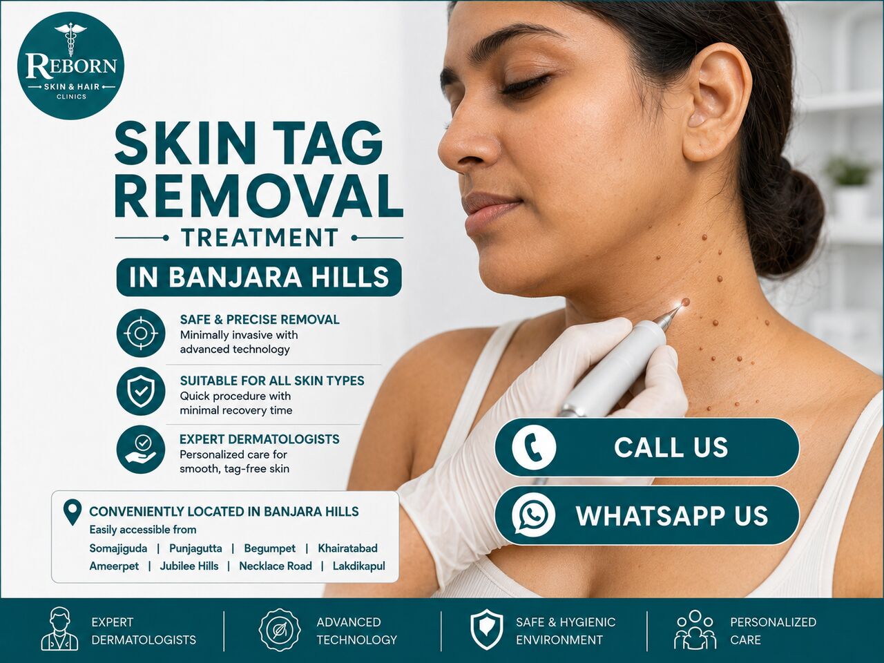 Hyderabad, Health & Beauty Items, INR 1000,  Skin Tag Removal Treatment Near Jubilee Hills & Banjara Hills
