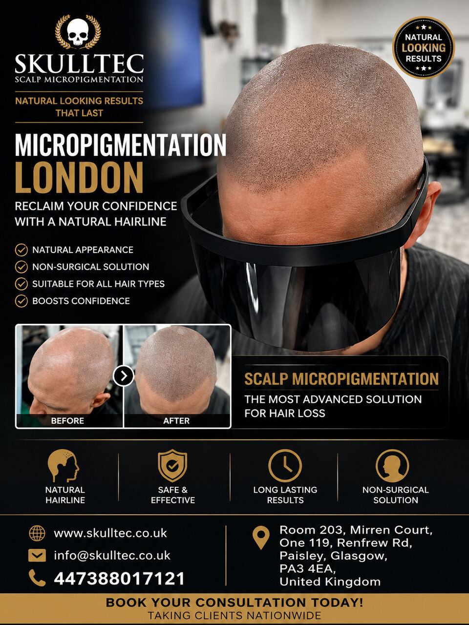 London, Health, Scalp Micropigmentation London &ndash; Expert Hair Pigmentation