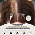 Women&rsquo;s Scalp Micropigmentation London &ndash; Natural Hairline Solution
