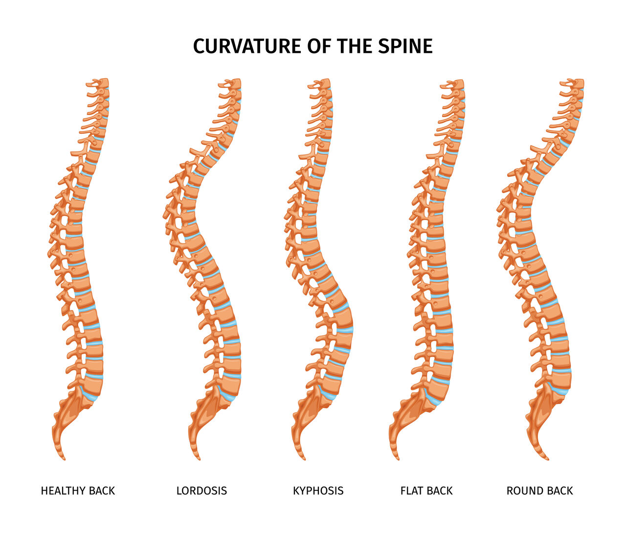 Visakhapatnam, Health, Spinal Trauma Treatment By Dr. B. Leela Prasad Amulya Hospital