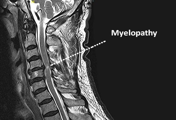 Visakhapatnam, Health, Spinal Trauma Treatment By Dr. B. Leela Prasad Amulya Hospital