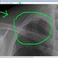 SAR 750,  Medical Software For Clinics With Pharmacy, Lab, And Billing