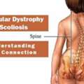 Muscular Dystrophy Treatment In Gurgaon : Effective Physiotherapy Treatment To Patients