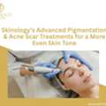 Skinology&rsquo;s Advanced Pigmentation & Acne Scar Treatments For A More Even Skin Tone