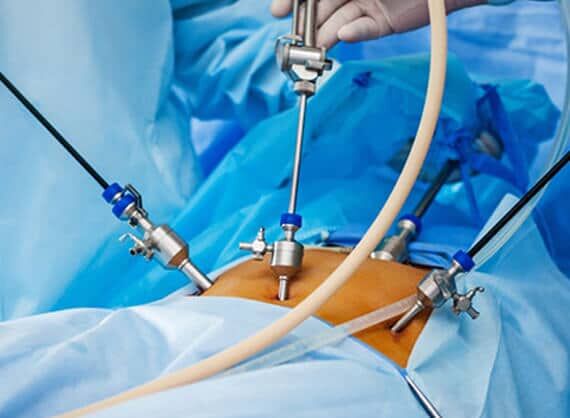New Delhi, Health, Laparoscopy For Infertility In Delhi - Dr Rhythm Gupta