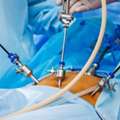 Laparoscopy For Infertility In Delhi - Dr Rhythm Gupta