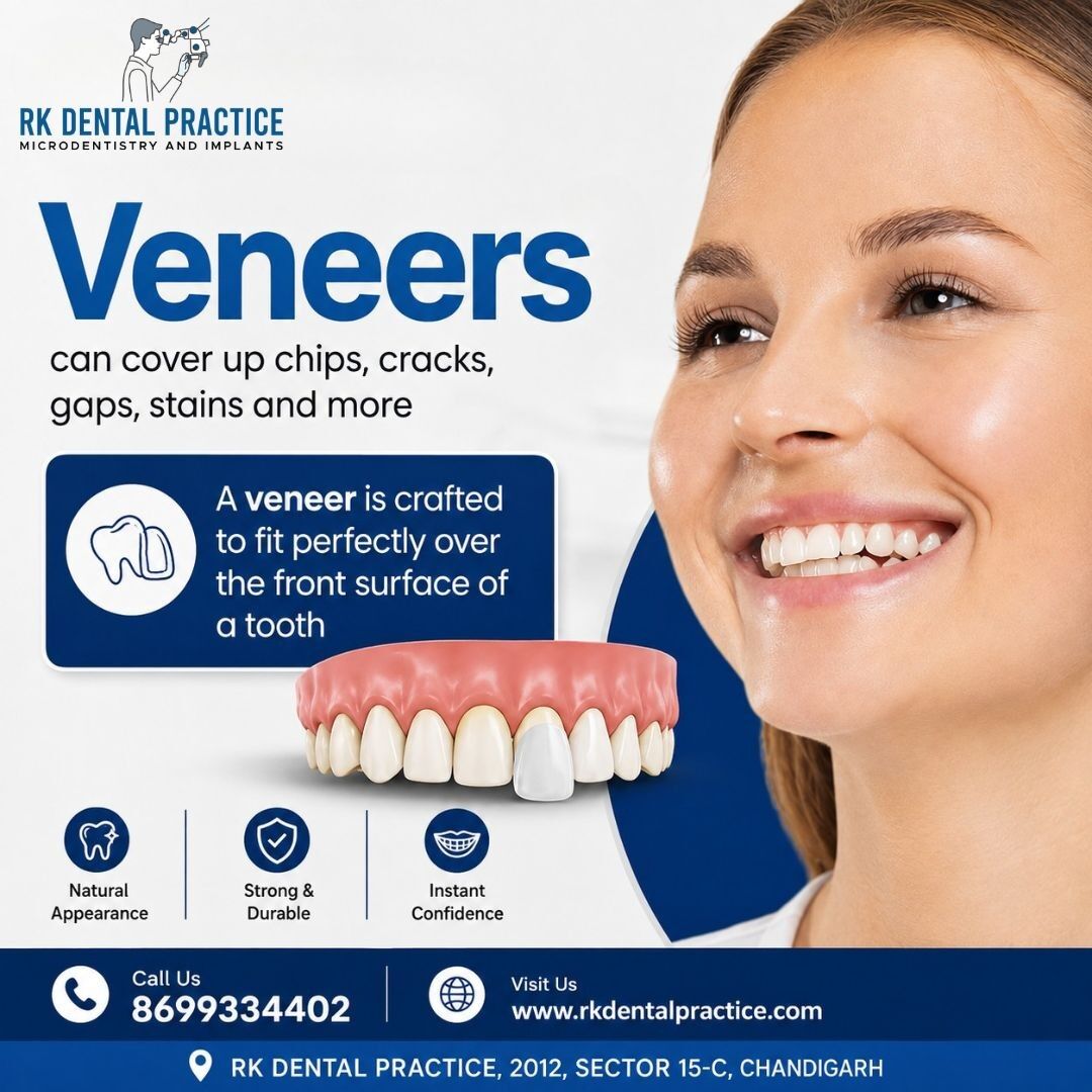 Chandigarh, Dental, Dental Veneers In Chandigarh For A Confident Smile