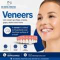 Dental Veneers In Chandigarh For A Confident Smile