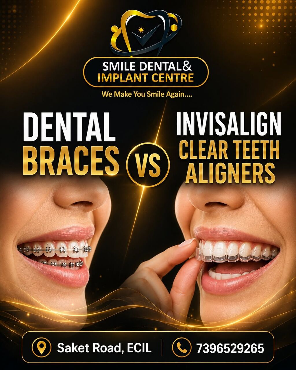 Hyderabad, Dental, Braces Or Invisalign? Let The Experts Help You Decide!