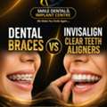 Braces Or Invisalign? Let The Experts Help You Decide!