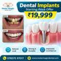 Affordable Dental Implants In Chandigarh Book Now
