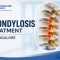 Spondylosis Treatment In Bangalore | Bangalore Back