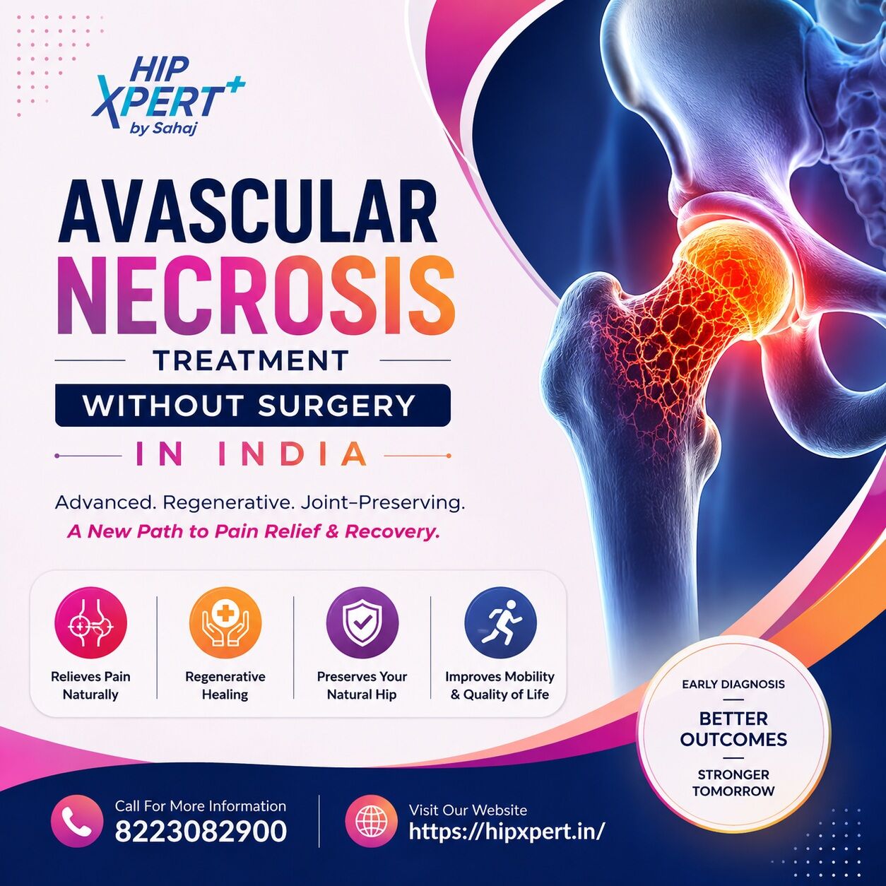 Indore, Health, Avascular Necrosis Treatment Without Surgery In India - Hip Xpert
