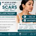 INR 4000,  Dermatologist-Guided CO2 Laser Treatment In Banjara Hills