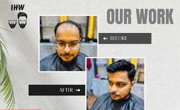 Kolkata, Fashion & Design, Hair Patch For Men In Sodepur Kolkata | Indian Hair World Sodepur