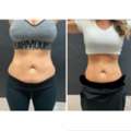 Body Fat Treatment Near Me &ndash; Advanced Body Contouring & Fat Reduction