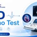 2D Echo Test For Accurate Heart Assessment