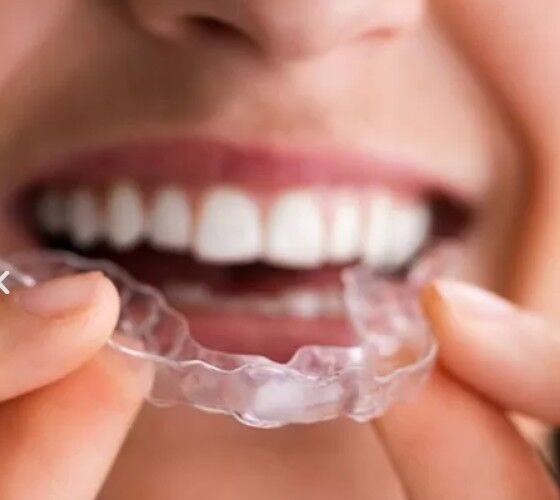 Ajman, Dental, Get A Straighter Smile With Invisible Aligners In Ajman
