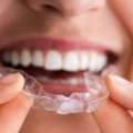 Get A Straighter Smile With Invisible Aligners In Ajman
