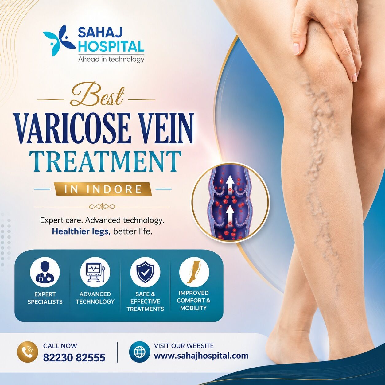 Indore, Health, Best Varicose Vein Treatment In Indore - Sahaj Hospital