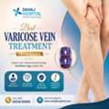 Best Varicose Vein Treatment In Indore - Sahaj Hospital