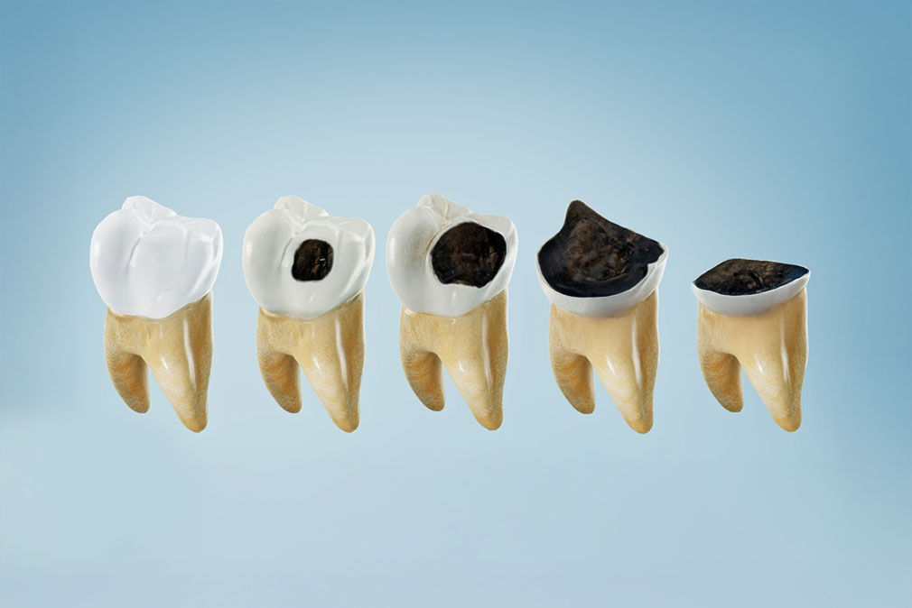 Singapore, Dental, Personalized Dental Services