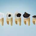 Personalized Dental Services