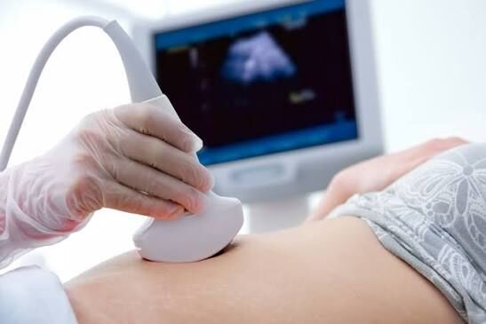 London, Health, Need A Pregnancy Ultrasound? What To Know Before Your Scan