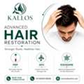 Hair PRP, GFC & Exosome Therapy For Hair Loss | Kallos Skin & Hair Clinic, Sainikpuri