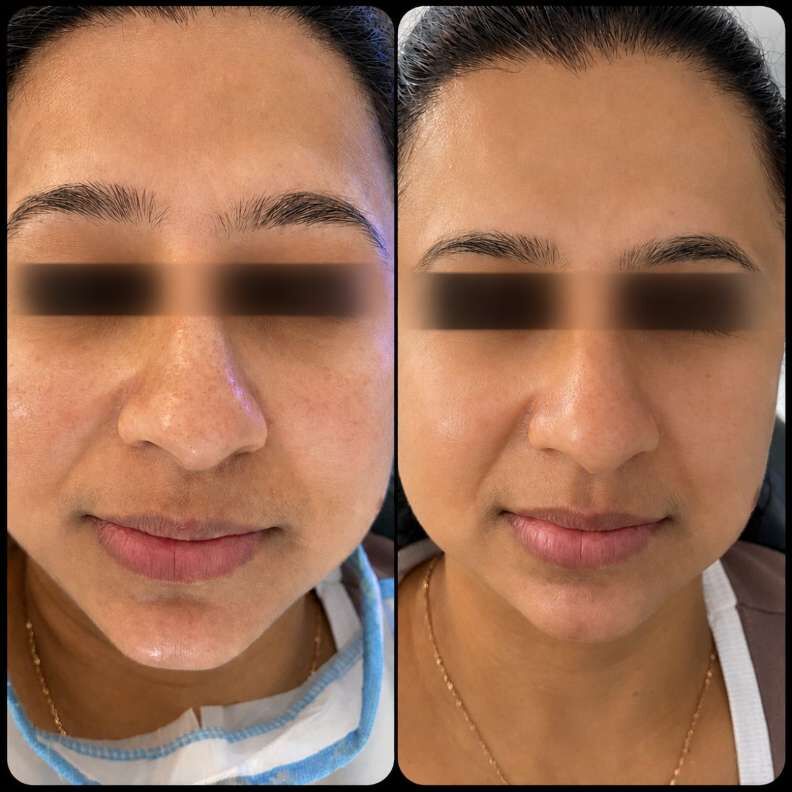 Kolkata, General, The Aesthetic House &ndash; Advanced Skin Care & Pigmentation Treatment In Rajarhat