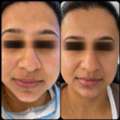 The Aesthetic House &ndash; Advanced Skin Care & Pigmentation Treatment In Rajarhat