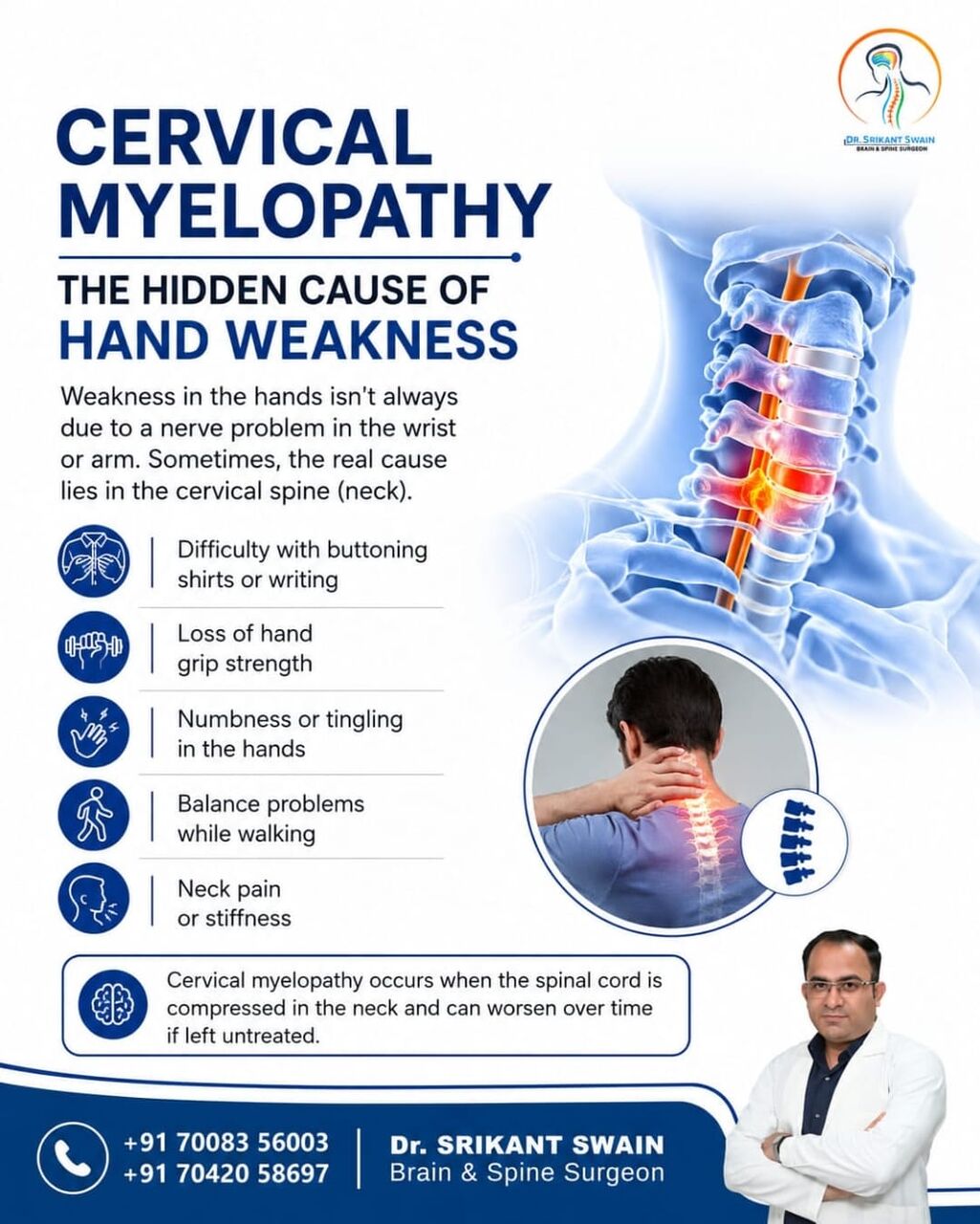 Bhubaneswar, Health, Cervical Myelopathy & Hand Weakness | Neurosurgeon In Bhubaneswar | Dr. Srikant Swain.