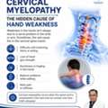 Cervical Myelopathy & Hand Weakness | Neurosurgeon In Bhubaneswar | Dr. Srikant Swain.