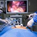 Trusted Laparoscopic Surgery In Lucknow