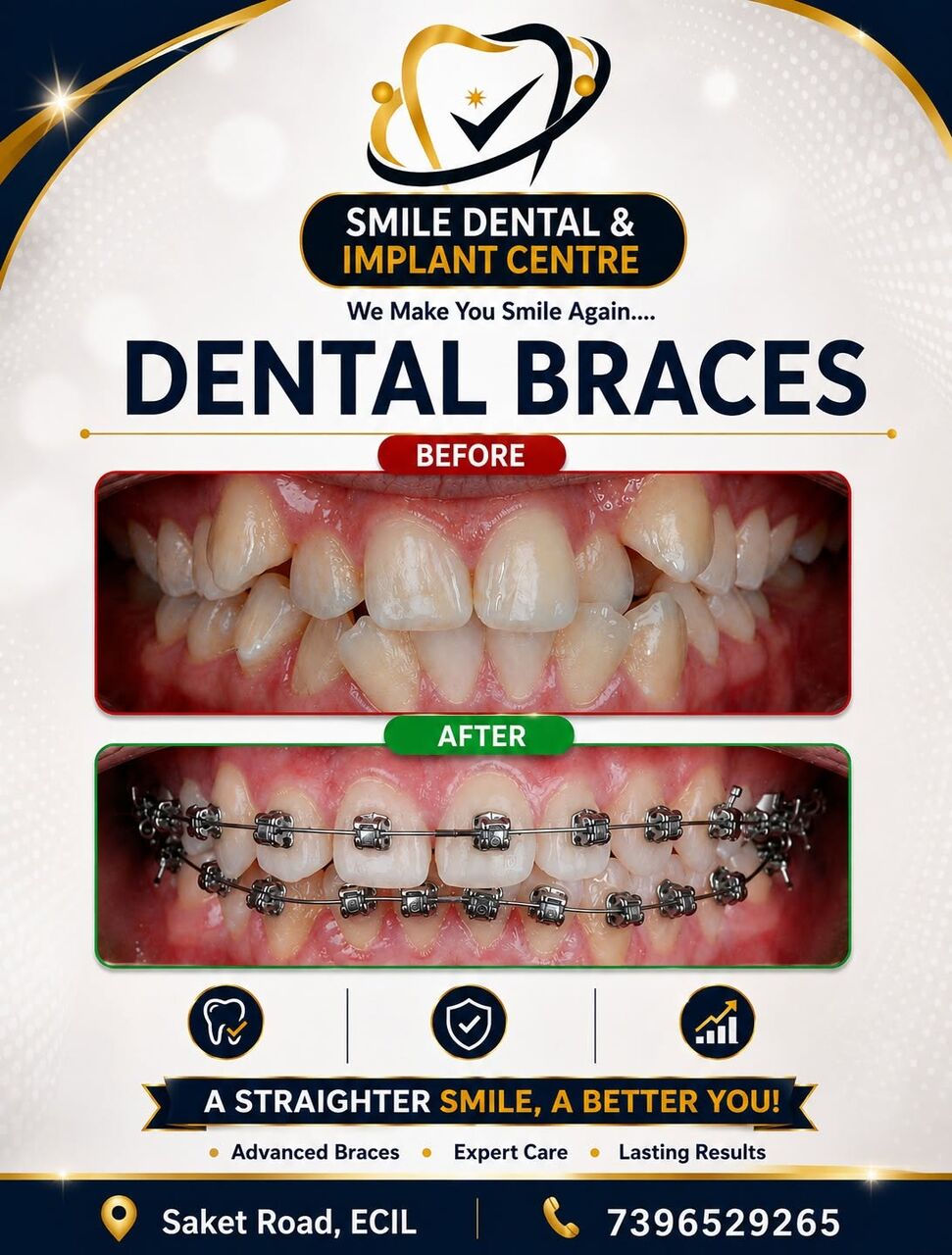 Hyderabad, Dental, Get A Straighter Smile With Advanced Dental Braces!