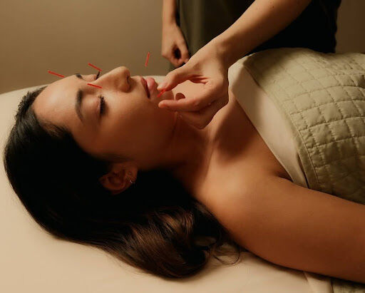 New York, Health, Best Acupuncture Practices On The Upper East Side