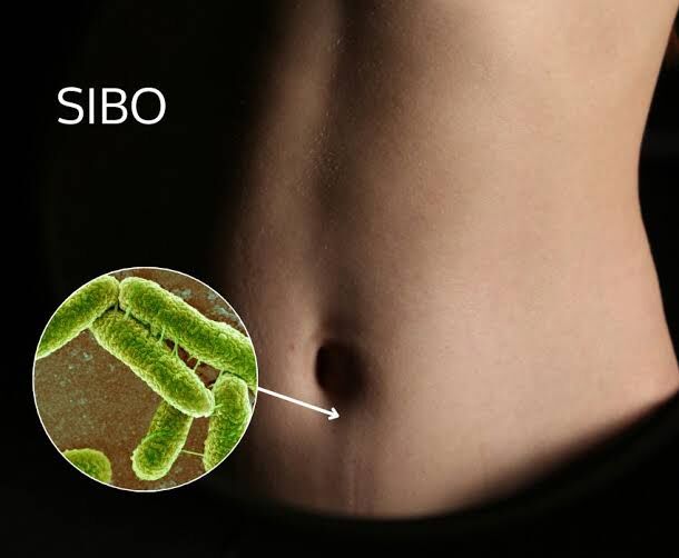 London, Health, Small Intestinal Bacterial Overgrowth: Symptoms To Know